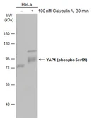 Anti-YAP1 (phospho Ser61) antibody used in Western Blot (WB). GTX133953